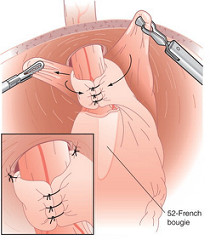 19867856995_0f8ed38048_m
